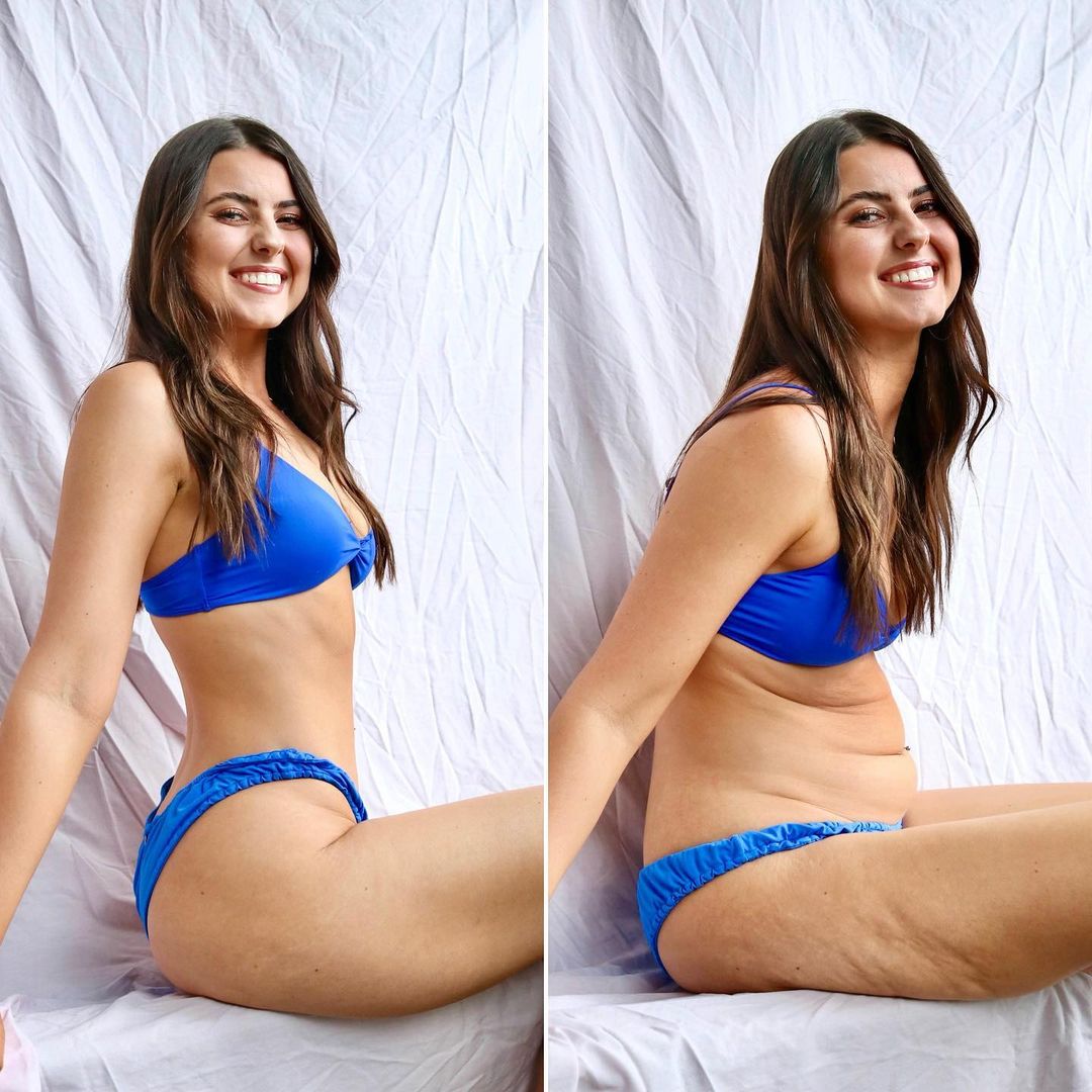#8 Bree Lenehan |: Una famosa influencer desafía los estándares de belleza poco realistas al publicar fotos de su cuerpo natural Zestradar
