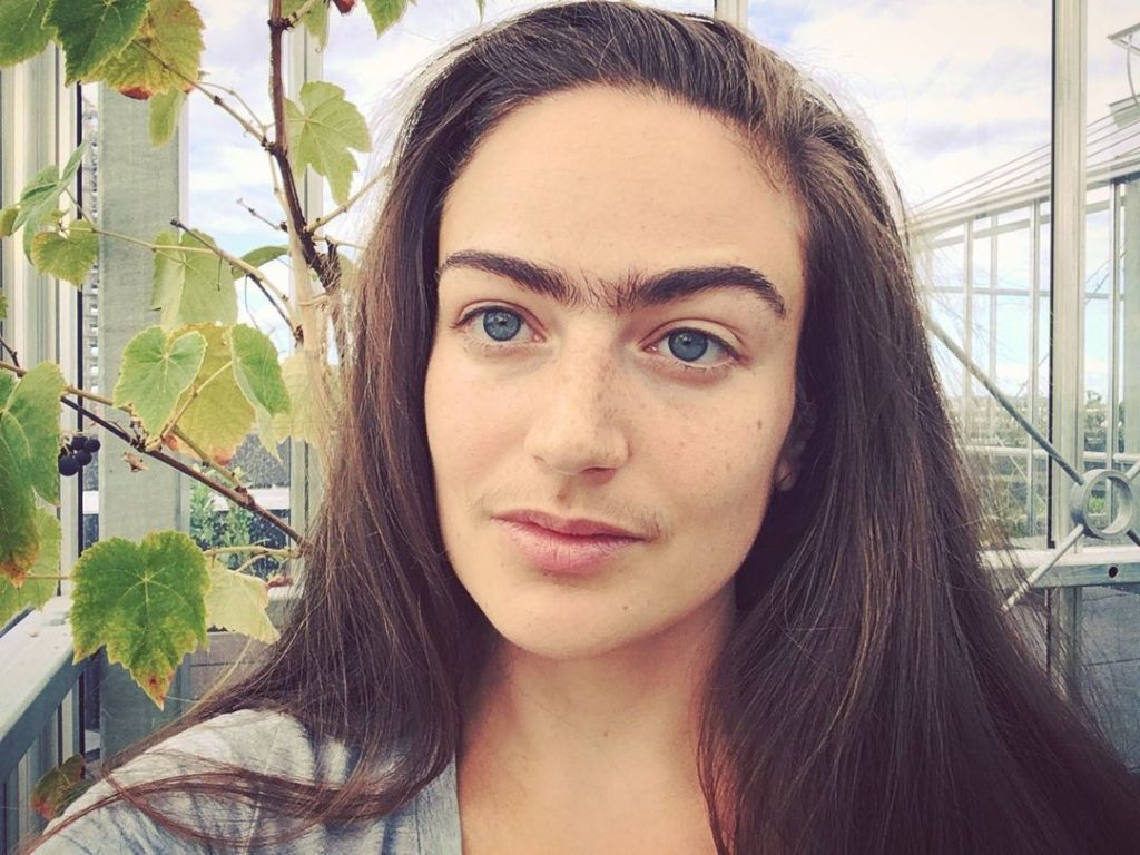 #3 | Esta mujer dejó de quitarse el vello facial durante un año, así es como cambió su vida | Zestradar