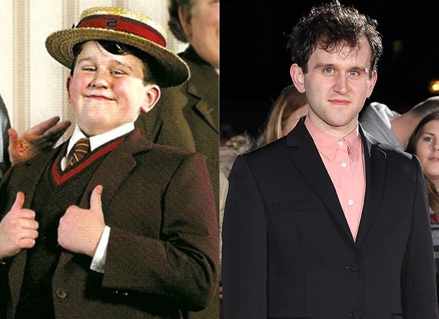 Harry Melling como Dudley Dursley |: El elenco de Harry Potter. entonces y ahora | Zestradar