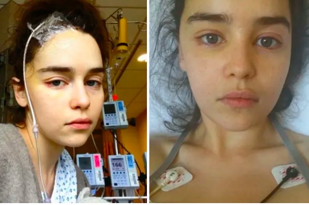 sufrió un aneurisma cerebral mientras filmaba GoT 8 cosas sorprendentes que no sabías sobre Emilia Clarke | Zestradar
