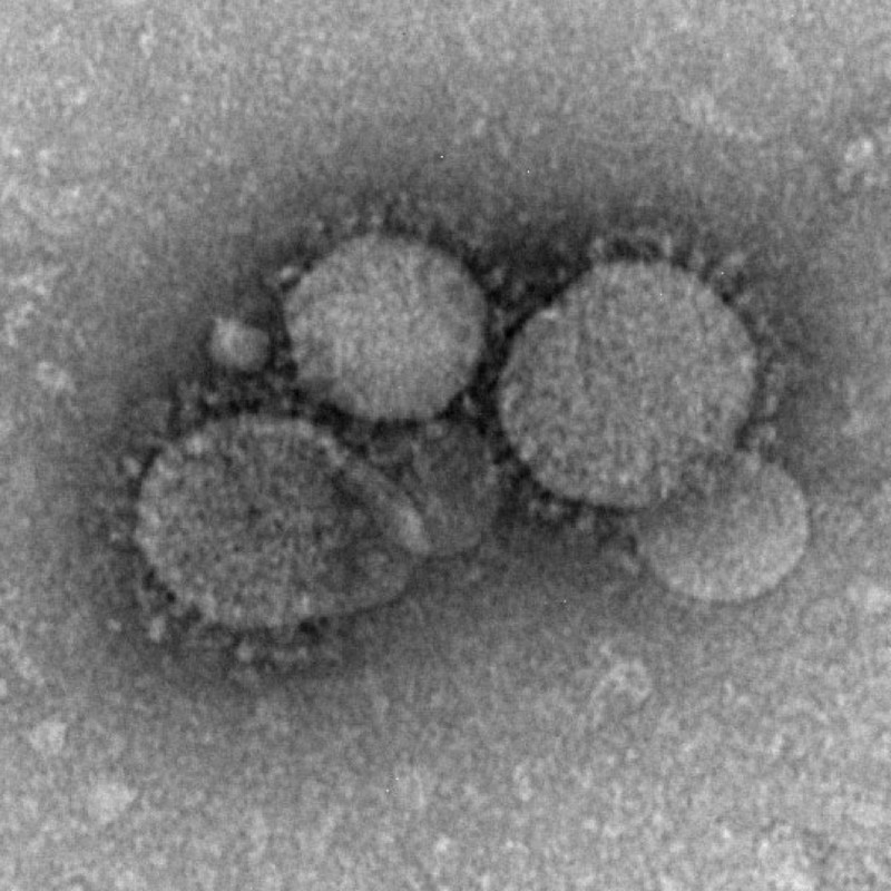 Híbrido MERS-Rabia |: Se han creado virus y bacterias mortales en laboratorios. Zestradar