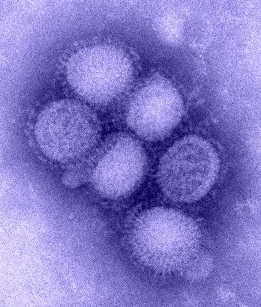 H1N1 Se han creado virus y bacterias mortales en laboratorios. Zestradar