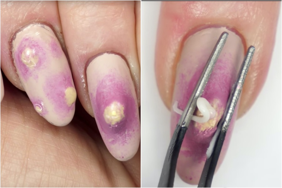 Arte de uñas con espinillas |: Las tendencias de arte de uñas más locas | Zestradar