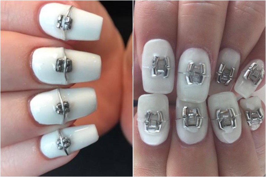 Brace Nail Art |: Las tendencias de arte de uñas más locas | Zestradar